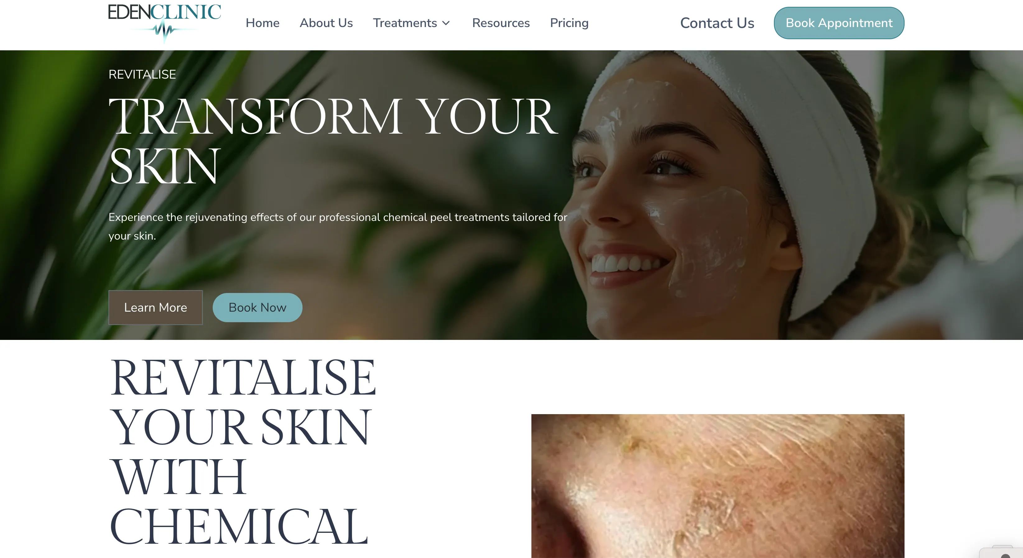 What is Testosterone Replacement Therapy? Eden Clinic